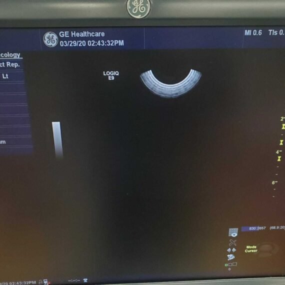 GE LOGIQ E9 XDclear 2.0 Ultrasound 10