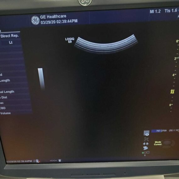 GE LOGIQ E9 XDclear 2.0 Ultrasound 7