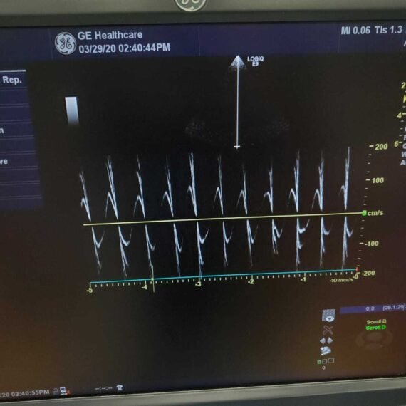 GE LOGIQ E9 XDclear 2.0 Ultrasound 8