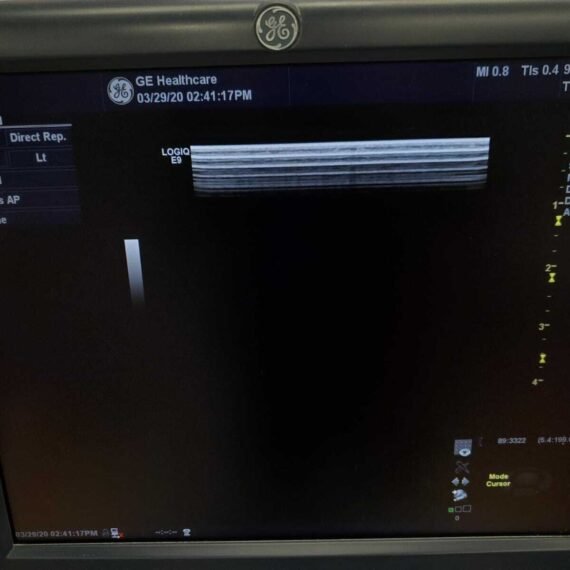 GE LOGIQ E9 XDclear 2.0 Ultrasound 9
