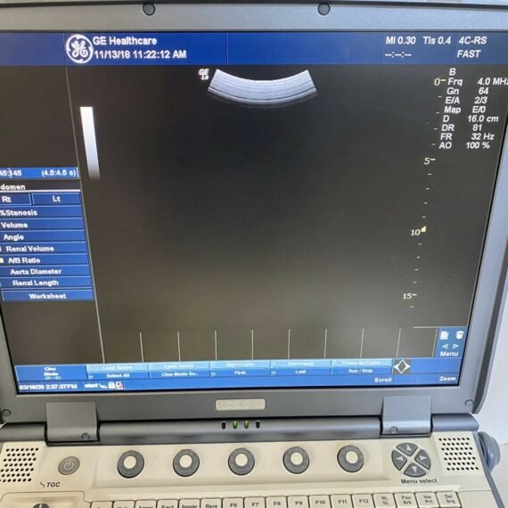 GE Logiq e Portable Ultrasound Machine 2