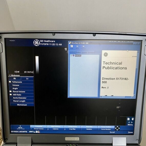 GE Logiq e Portable Ultrasound Machine 3