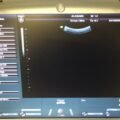 GE Voluson I Ultrasound System 2