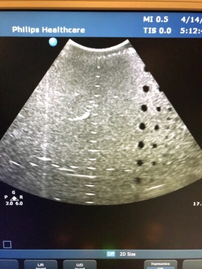 Philips CX30 Compact Xtreme ultrasound system 8