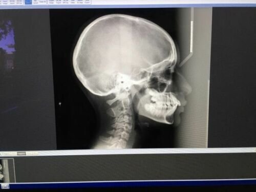 Planmeca ProMax 2D imaging units 1