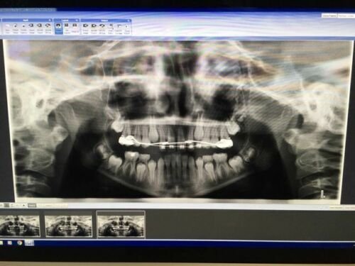 Planmeca ProMax 2D imaging units 2