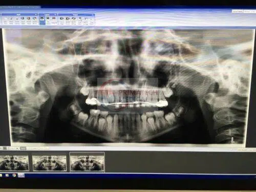 Planmeca ProMax 2D imaging units 2