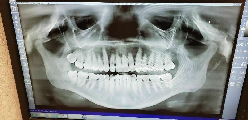 Sirona Galileos Comfort Plus 3
