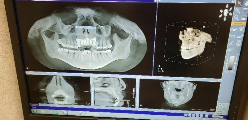 Sirona Galileos Comfort Plus 4