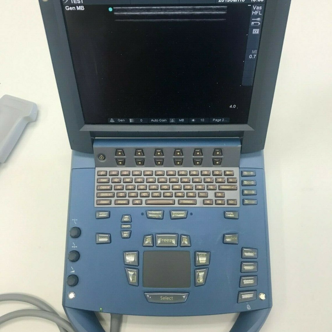 Micromaxx SonoSite MicroMaxx Ultrasound with HFL38 PROBE - KANAWHA MEDICAL SUPPLY INC