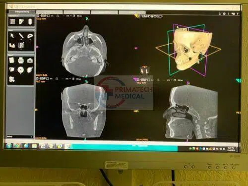 KODAK 9500 Cone Beam 3D System 4