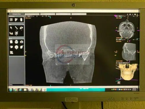 KODAK 9500 Cone Beam 3D System 6