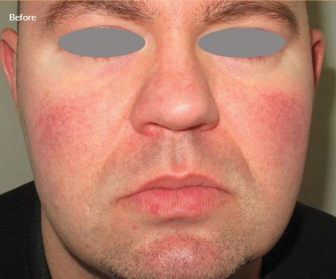 Lumenis Stellar M22- IPL Laser Machine 4 3