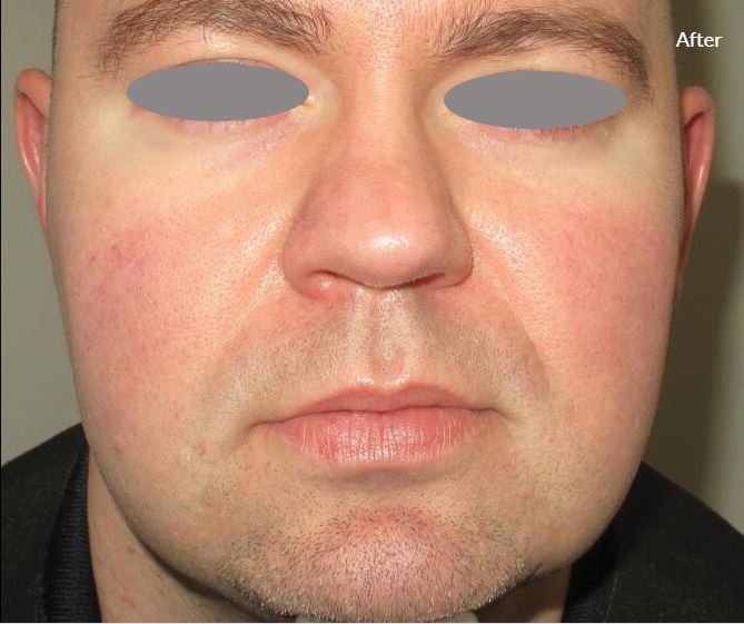 Lumenis Stellar M22- IPL Laser Machine 5 4