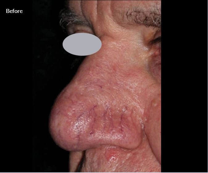 Lumenis Stellar M22- IPL Laser Machine 6 5