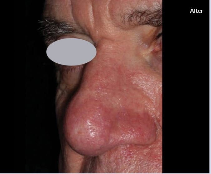 Lumenis Stellar M22- IPL Laser Machine 7 6