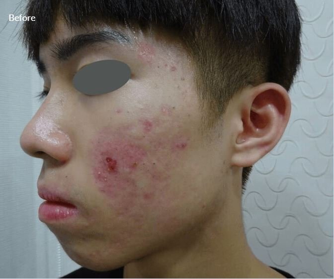 Lumenis Stellar M22- IPL Laser Machine 8 7