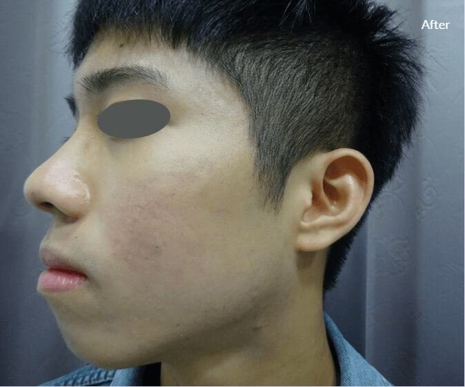 Lumenis Stellar M22- IPL Laser Machine 9 8