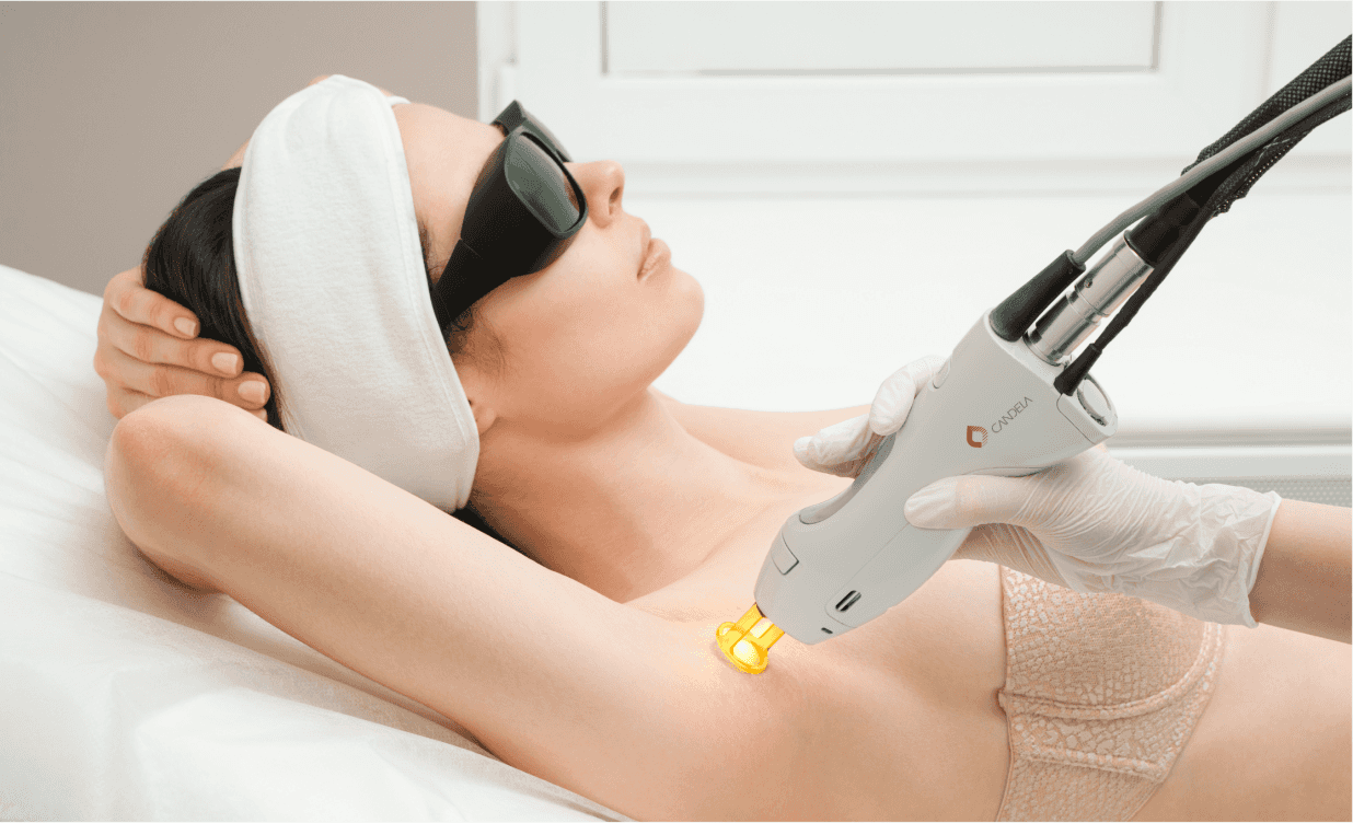 Candela Gentlemax Pro PLus Laser Hair Removal Machine 1 GentleMax-Pro-Laser-Treatment