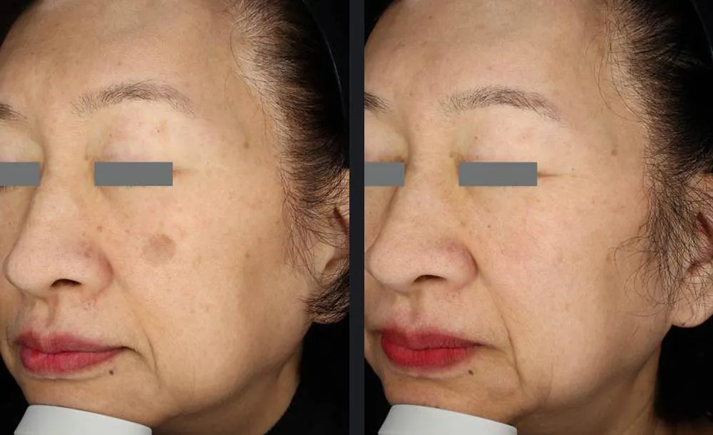 picoway pigmentation p1 nocredit.jpg