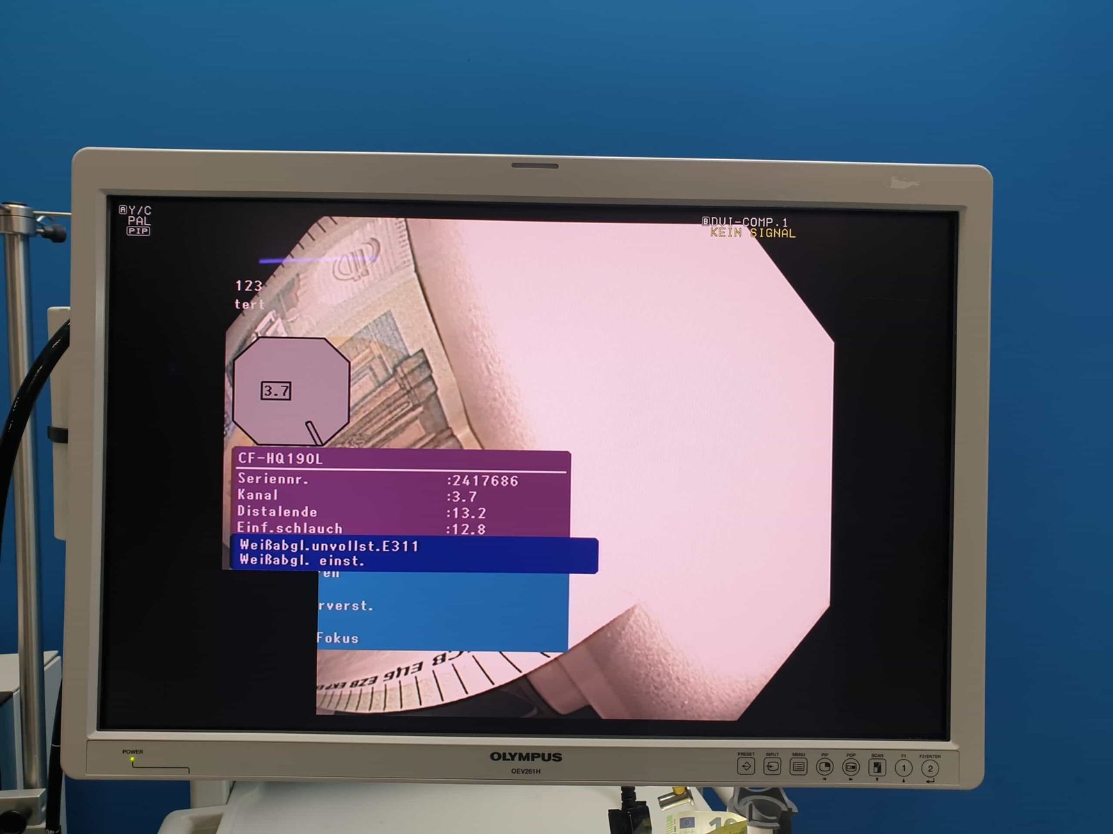 Olympus CF-HQ190L EVIS EXERA III Video Colonoscope 1 Olympus CF-HQ190L