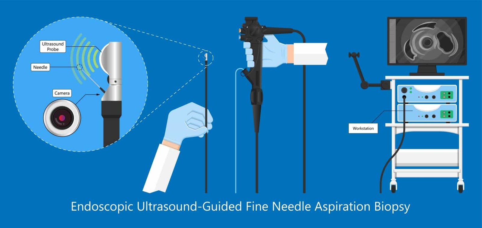 Upgrading Your Colonoscopy Devices
