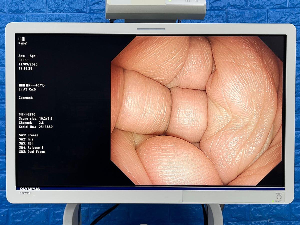 Olympus GIF-HQ290 Video Gastroscope 1 OLYMPUS GIF-HQ290